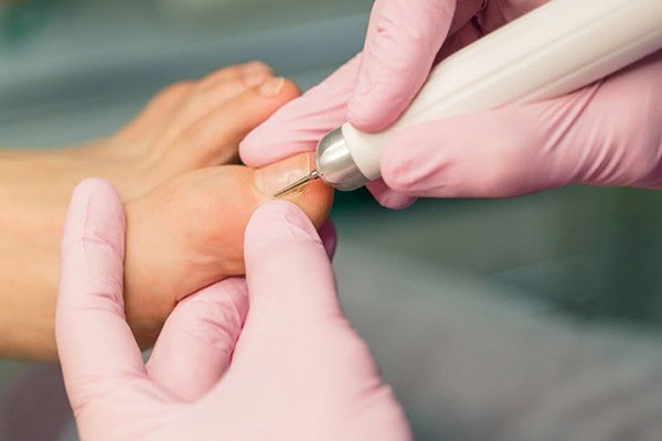 ناخنهای مرتب با پدیکور خشک