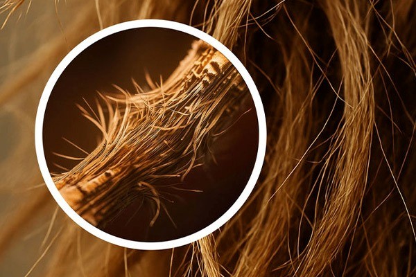 نقش موخوره در کدر شدن مو 