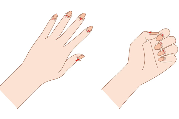 علت پوست پوست شدن دور ناخن