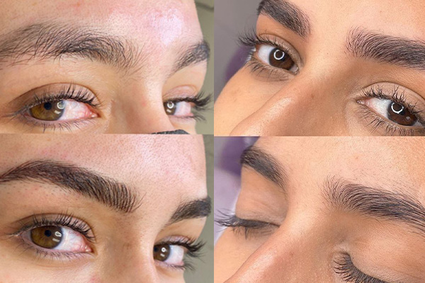 عوارض فیبروز ابرو